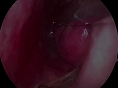 일회용 초소형 유연성 신경조사체 PLA407